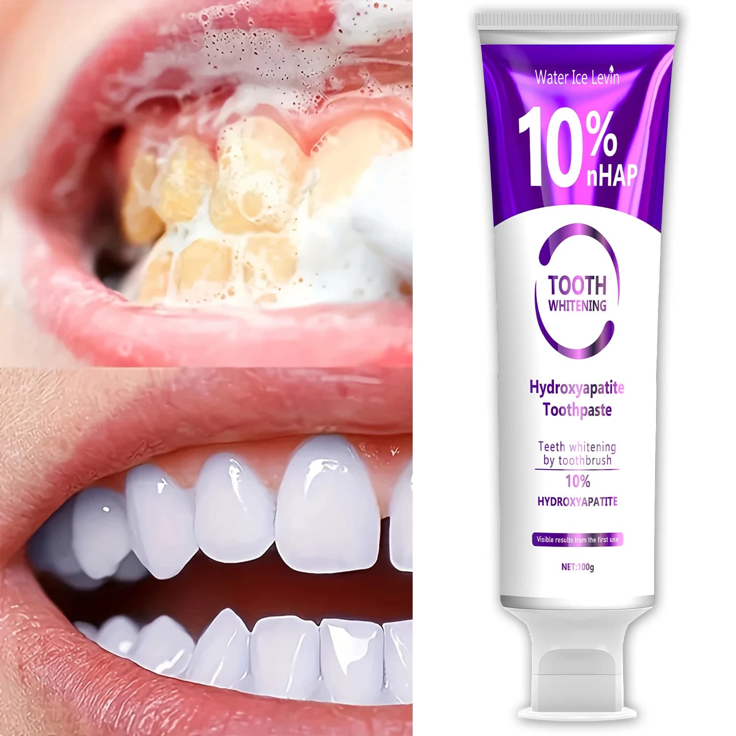 Oxidative teeth whitening Hydrosapatite toothpaste tooth whitening 10% Hydroxyapatite Can see effect for the first time