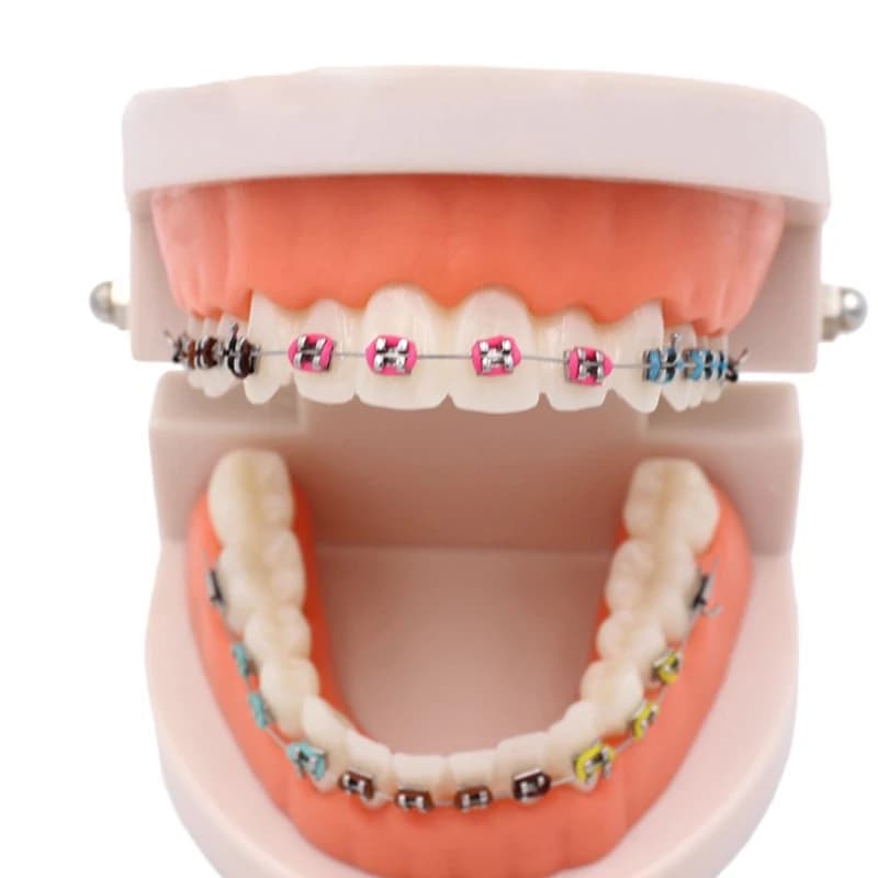 Dental Orthodontic Treatment Teeth Model With Bracket Arch Wire Buccal Tube Ligature Ties Dentist Lab Tooth Model Teaching Tools