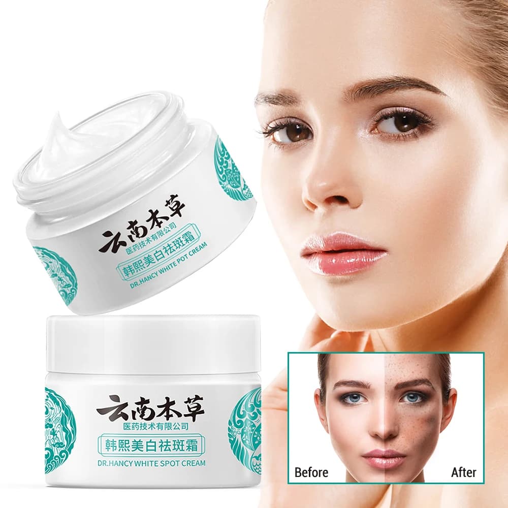 20g Pianta alle erbe Crema sbiancante per il viso Idratante Schiarente Pelle Dissolvenza Macchie scure Crema per la rimozione delle lentiggini Prodotti per la cura della pelle