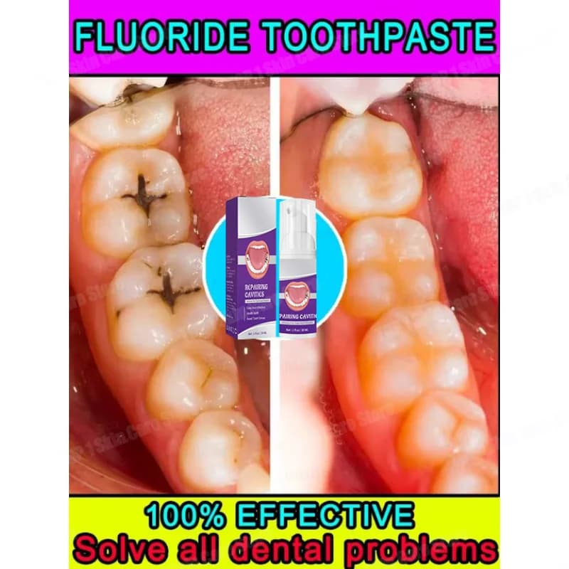 Hot Sales The most sold, scientific cavity repairs, remove cavities, clean plaque, clean teeth and refresh breath