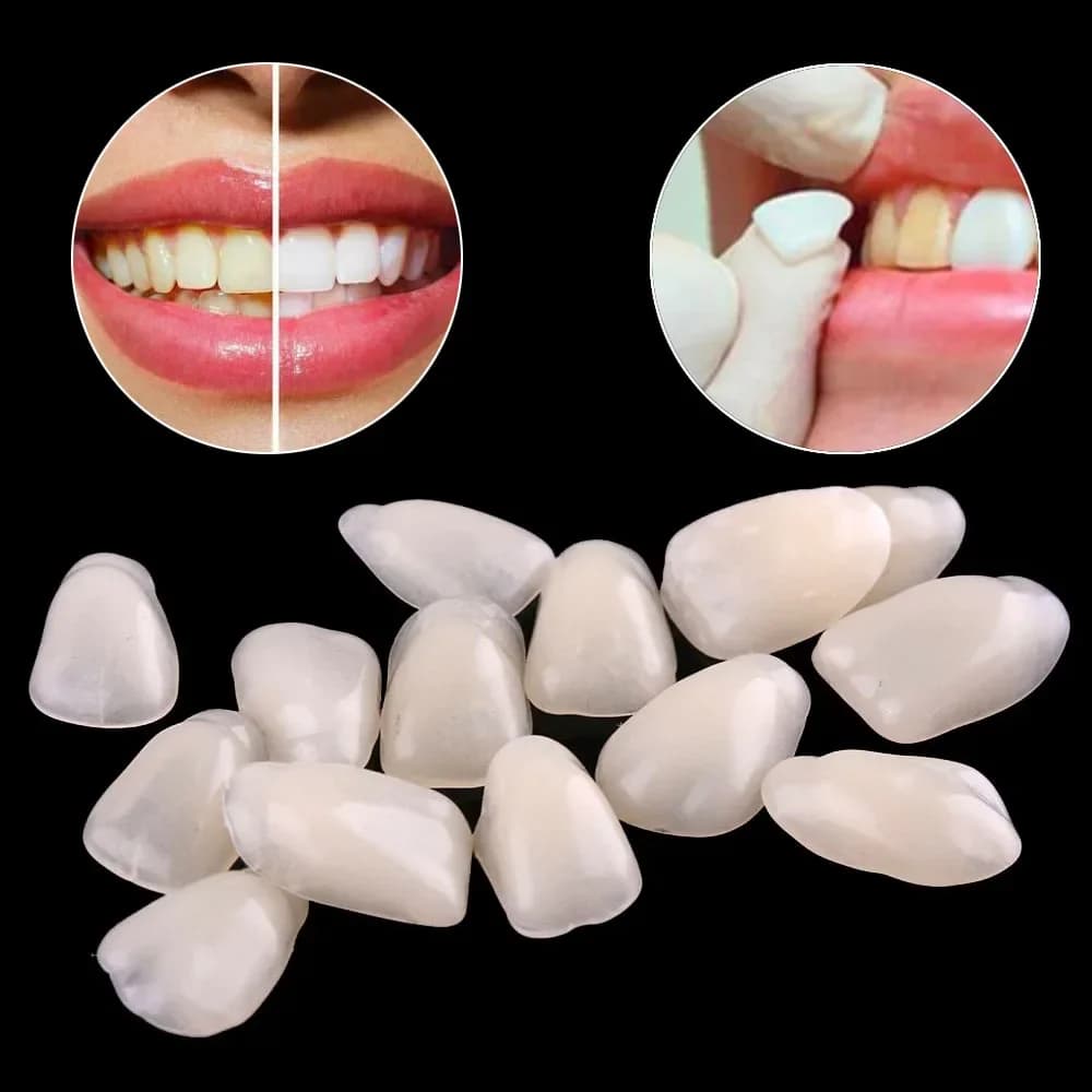 70pcs Fake Dental Teeth impiallacciature Ultra sottile corona temporanea porcellana materiale dentale igiene orale resina sbiancante anteriore superiore