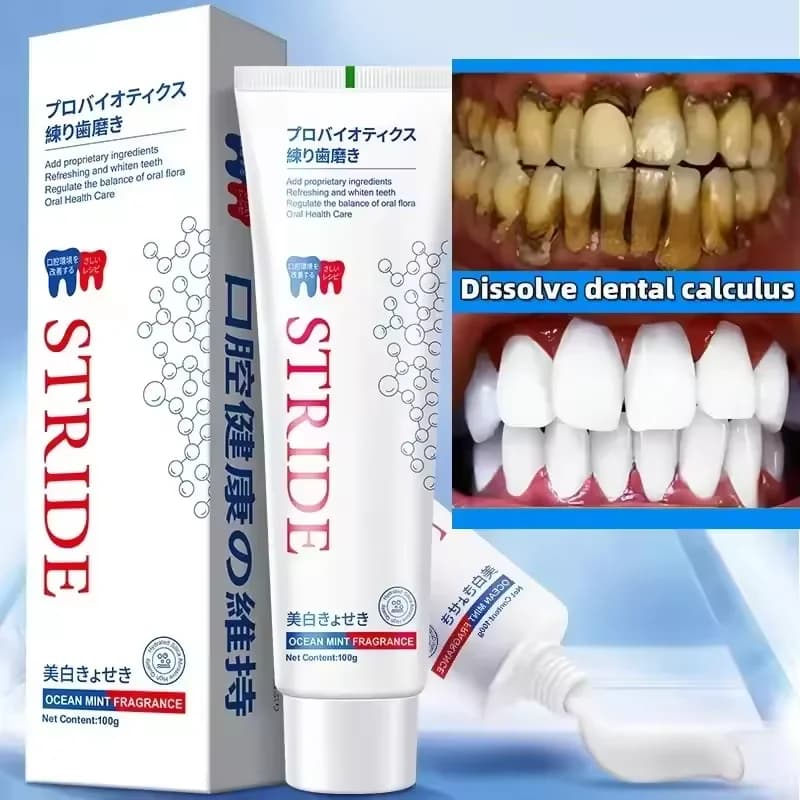 Rimozione del tartaro dentale Rimozione dell'alito cattivo Sbiancamento dei denti Dentifricio schiarente Prevenire la parodontite Pulizia dentale Nuovo