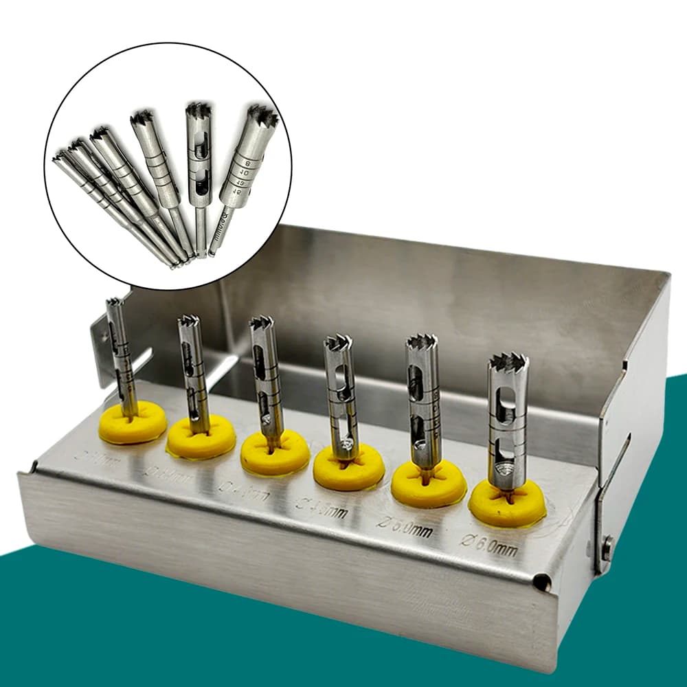 Kit trapano per impianti dentali da 6 pezzi per chirurgia implantologica - Frese trefini lunghe, set di strumenti dentali chirurgici in lega di titanio