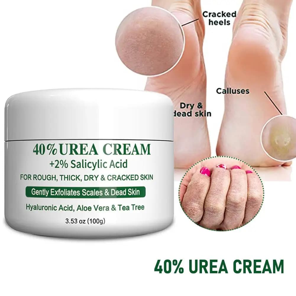Crema per l'urea al 42% Crema per il corpo anti-screpolature autunnale e invernale Crema idratante per l'urea pura inglese