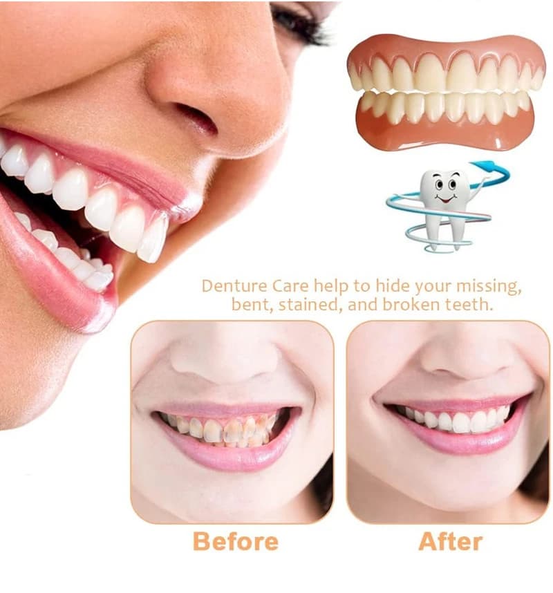 Silicone prosthesis kit Temporary orthodontic teeth Soft prosthetic lining Teeth whitening Upper and Bottom teeth Fake dental hygiene