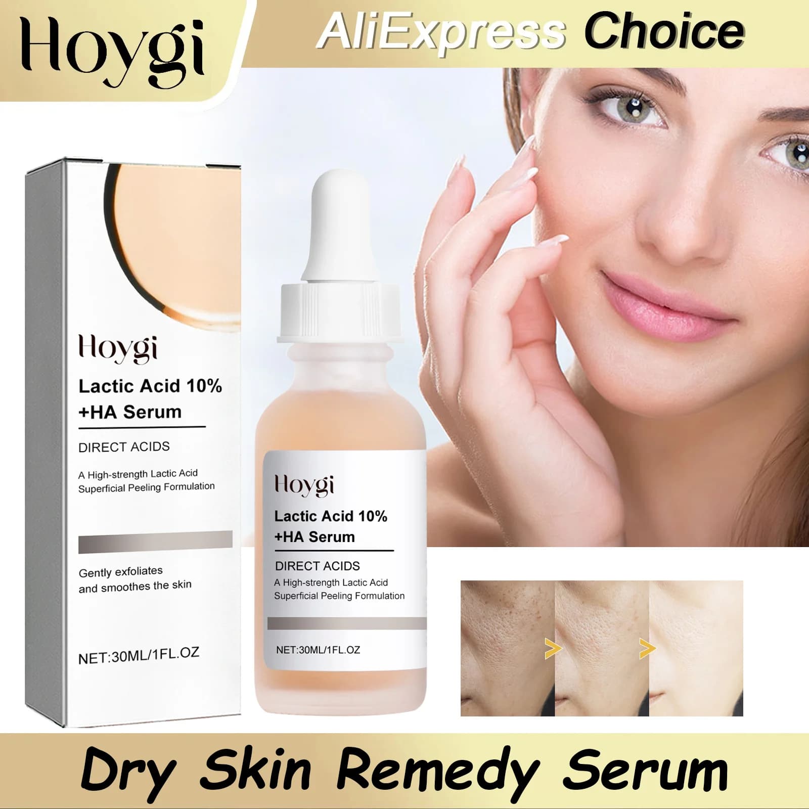 HOYGI Siero Viso all'Acido Lattico per Restringere i Pori, Rassodante, Levigante, Idratante, Illuminante e Anti-Età