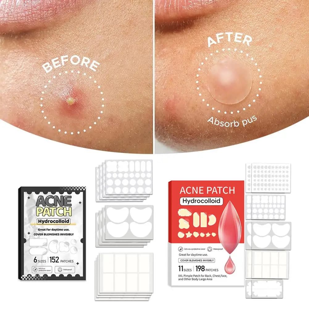 10/20/152/198 pezzi Set di scatole per cerotti per acne di grandi dimensioni, cerotti per la mascella del naso per il controllo dell'olio per punti neri e comedoni chiusi Cura del viso Z2Q6