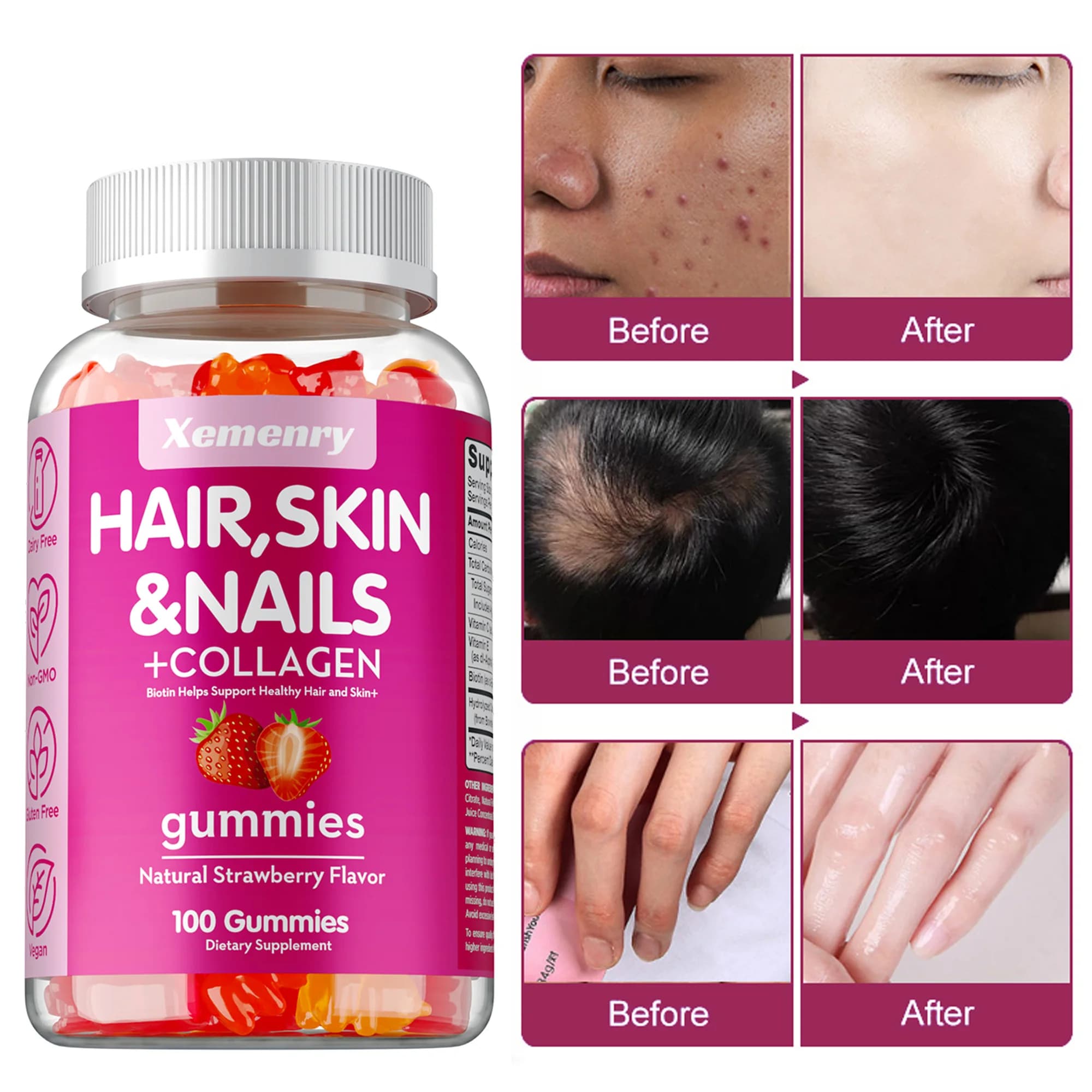 High-power biotin gullies: for healthy hair, skin and nails, hair vitamins for men and women | Gluten-free