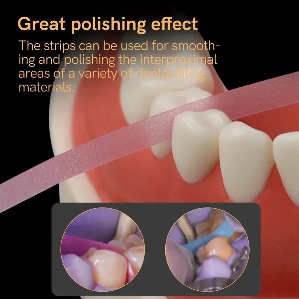 4mm*6m Glossy Strip, Material for Dentisting and Whitening in Resin, for Dentistry