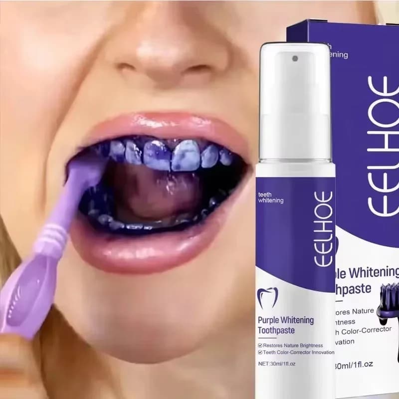 Bestseller 2026 White toothpaste: Goodbye to the Yellow Tooths, Oral Hygiene Tool and Tooth Care
