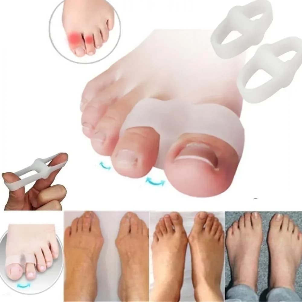Correttore per alluce valgo a 2 fori Separatori per dita antidolorifiche Piastre in gel per dita sovrapposte e allineamento dell'alluce