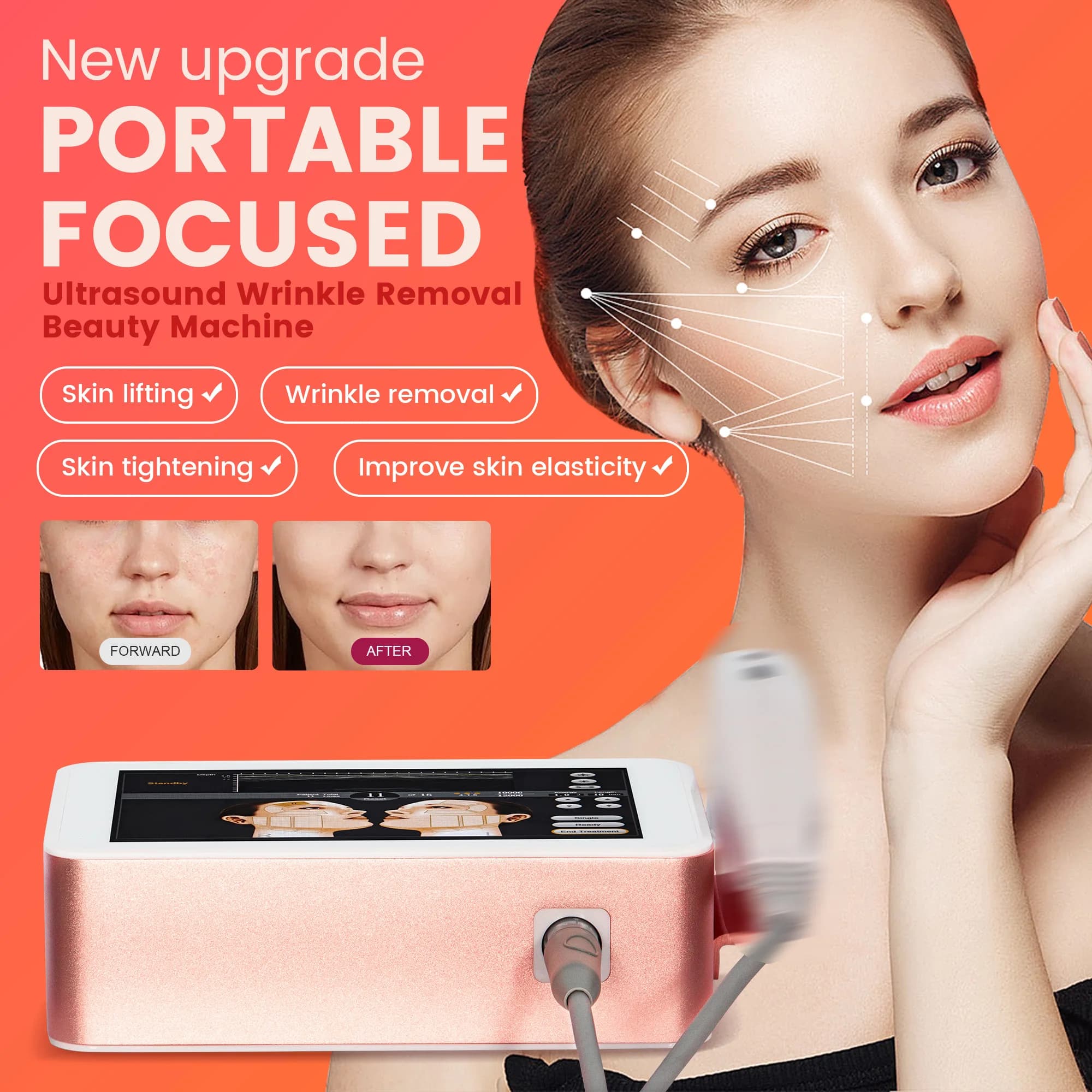 Beauty Lifting Machine for Collagen Regeneration Portable Lifting System Smas Skin Strengthening Neck Lifting Face