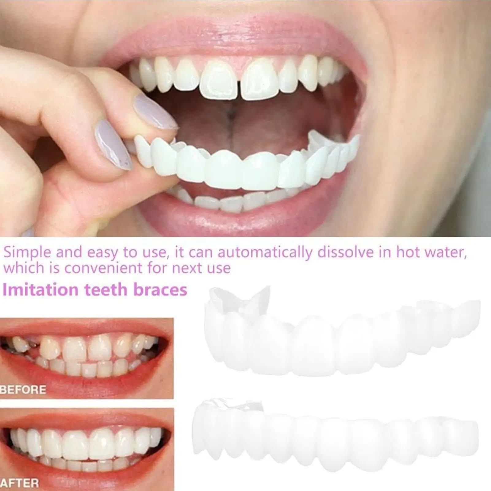 2 pz Uomo Donna Denti Temporanei Impiallacciature Superiore Inferiore Impiallacciature Denti Temporanei Sorriso Miglioratore Riutilizzabile Denti Finti Copertura Schiarente