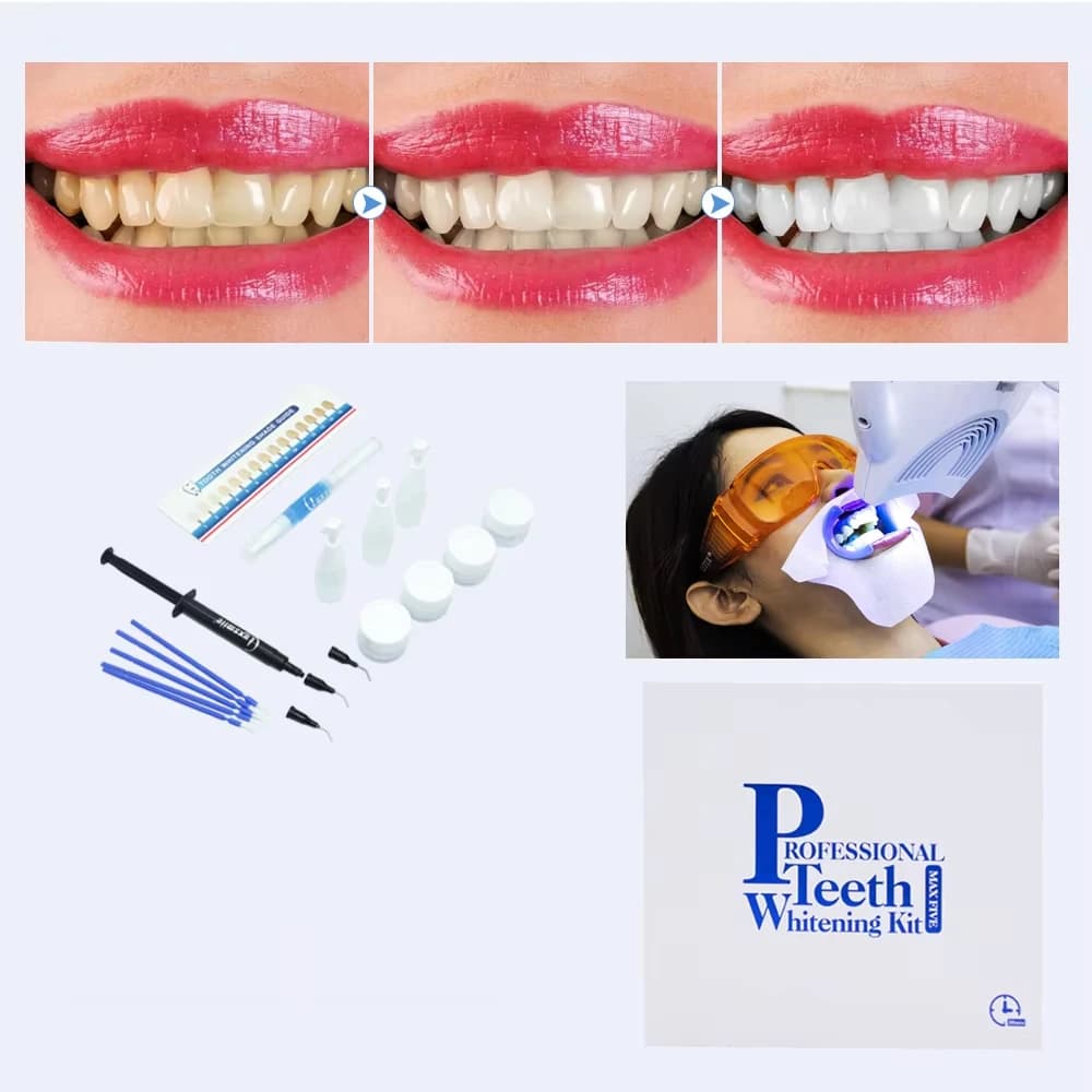 Luxsmile Dental Whitening Kit Whitening Gel Whitening Kit For Tooth Powder For Professional LED Whitening Lamp For Teeth