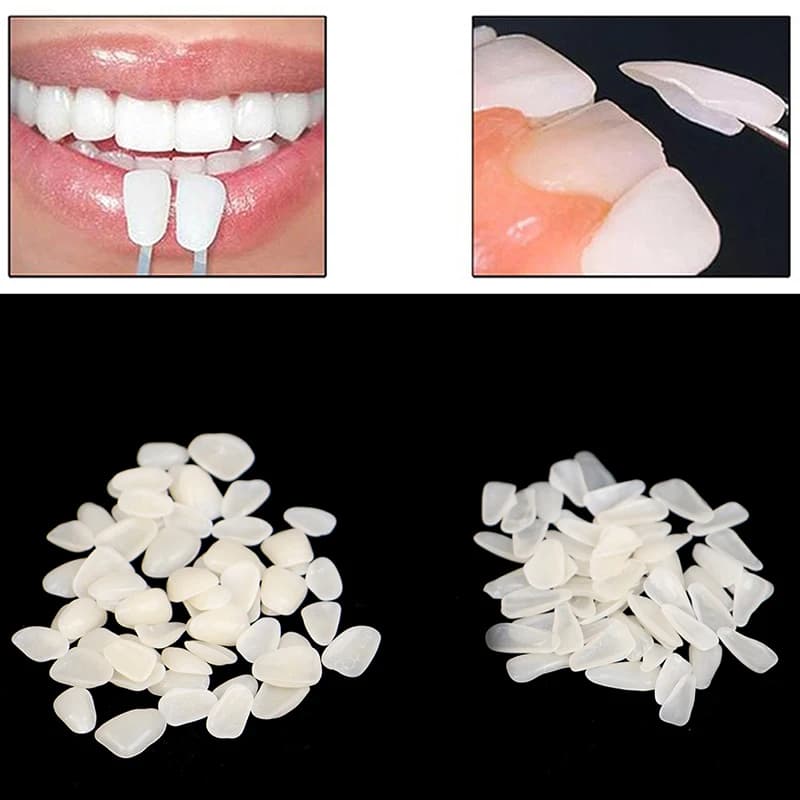 60PC Dentale Ultra-Sottile Sbiancamento Impiallacciature Resina Porcellana Materiali Temporanei Denti Superiore Sbiancamento Anteriore Pellicola Dentale (Senza Colla)