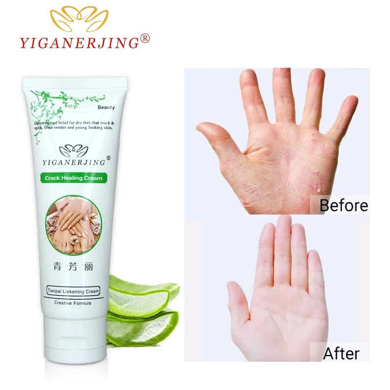 2Pc YIGANERJING Hand Cream Hydrating Moisturizing Repair Dry Rough Hand Care Non-Greasy Hand Lotion 80G