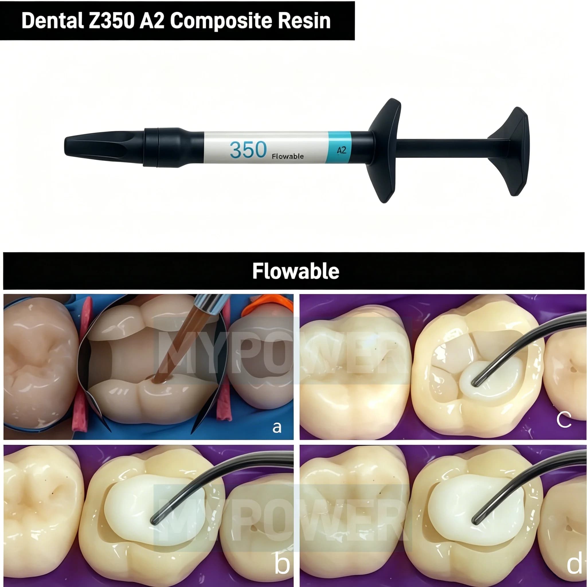 Resina Composita Dentale Fotopolimerizzabile Z350 A2 Shade Light - Materiale Restaurativo Fluido da 2g per Otturazioni, Faccette e Sbiancamento dei Denti
