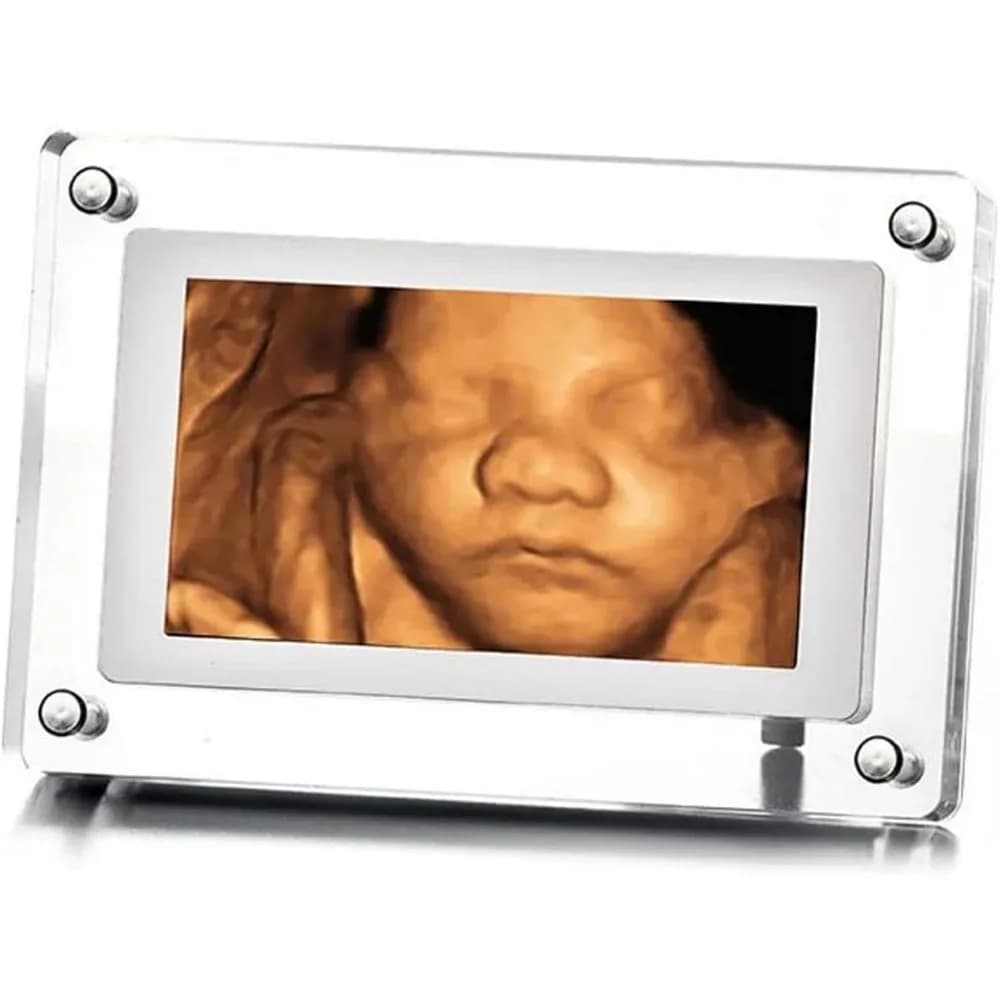 Cornice digitale da 7 pollici per riproduzione di immagini ecografiche, ricaricabile, memoria da 4 GB, caricamento USB di foto e video, formato verticale e orizzontale