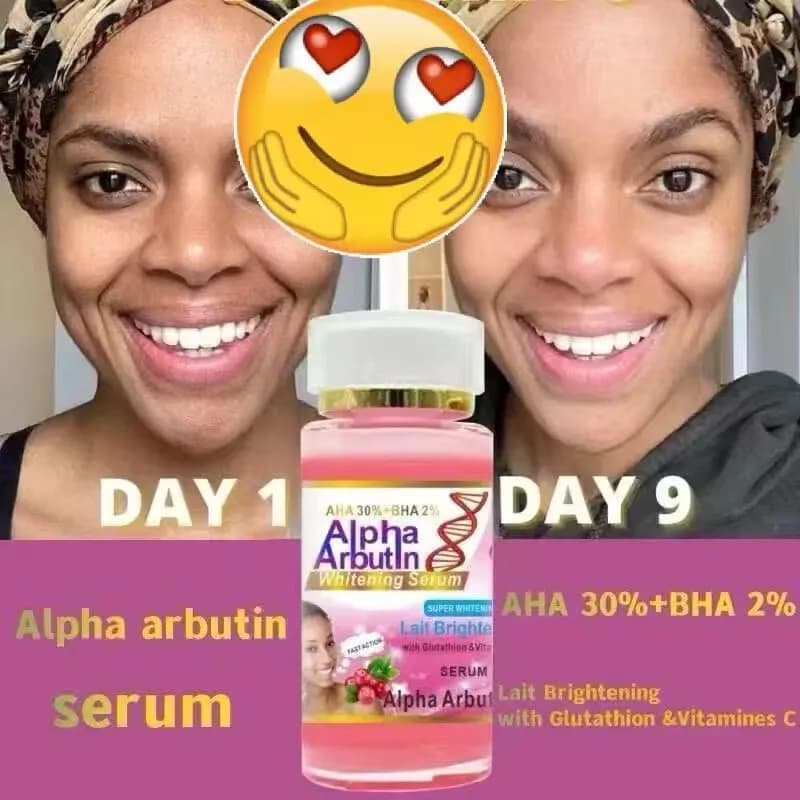 NUOVO AHA 30% + BHA 2% Dissolvenza linee sottili Rassodante Siero viso Idratante schiarente Vitamina C Acido ialuronico Siero viso Ridurre i pori