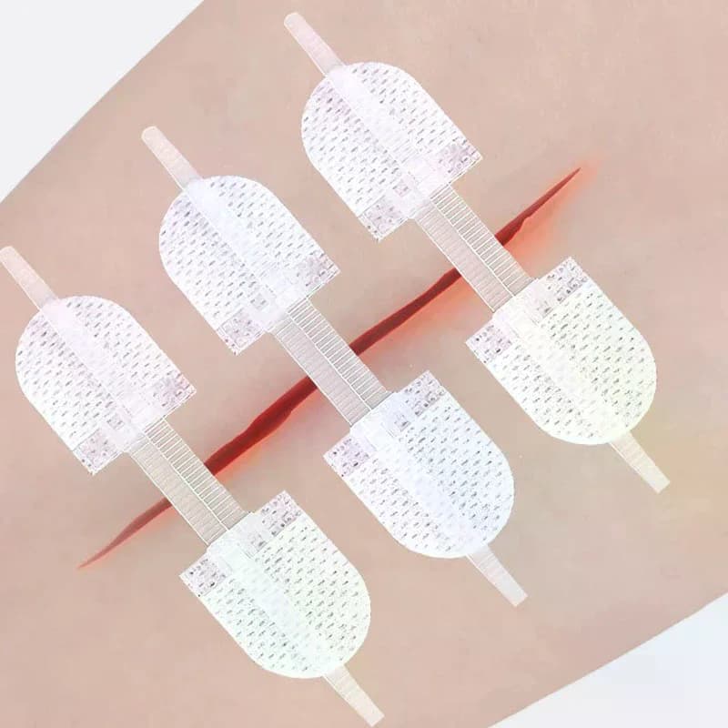 Breathable Seamless Elastic Strap Zipper Wound Closure Patches For Wound Care Braces Supports - Seamless Zip Sutures Bandages