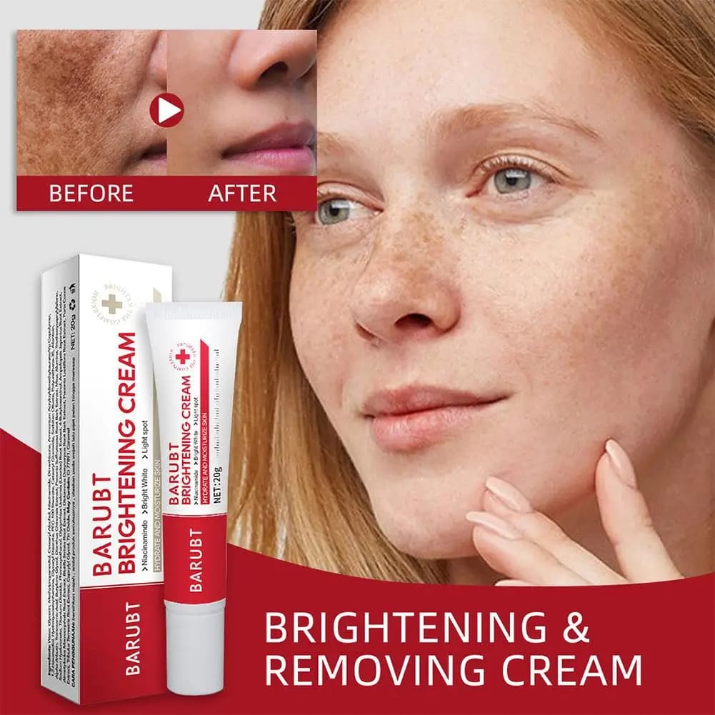 Crema Viso Schiarente per Rimozione Lentiggini, Correttore Macchie Scure e Melasma, Schiarisce la Pigmentazione della Melanina, Illumina e Cura la Bellezza