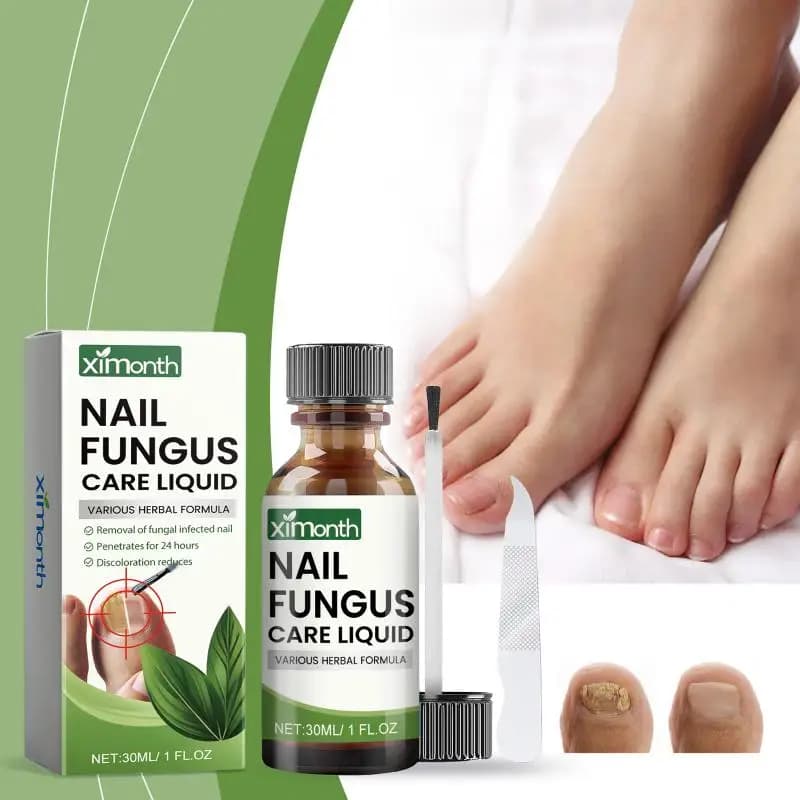 Kit Riparazione Unghie Mani e Piedi, Cura Unghie Piedi, Smalto per Onicomicosi, Ammorbidente Unghie, Liquido per Unghie Incarnite