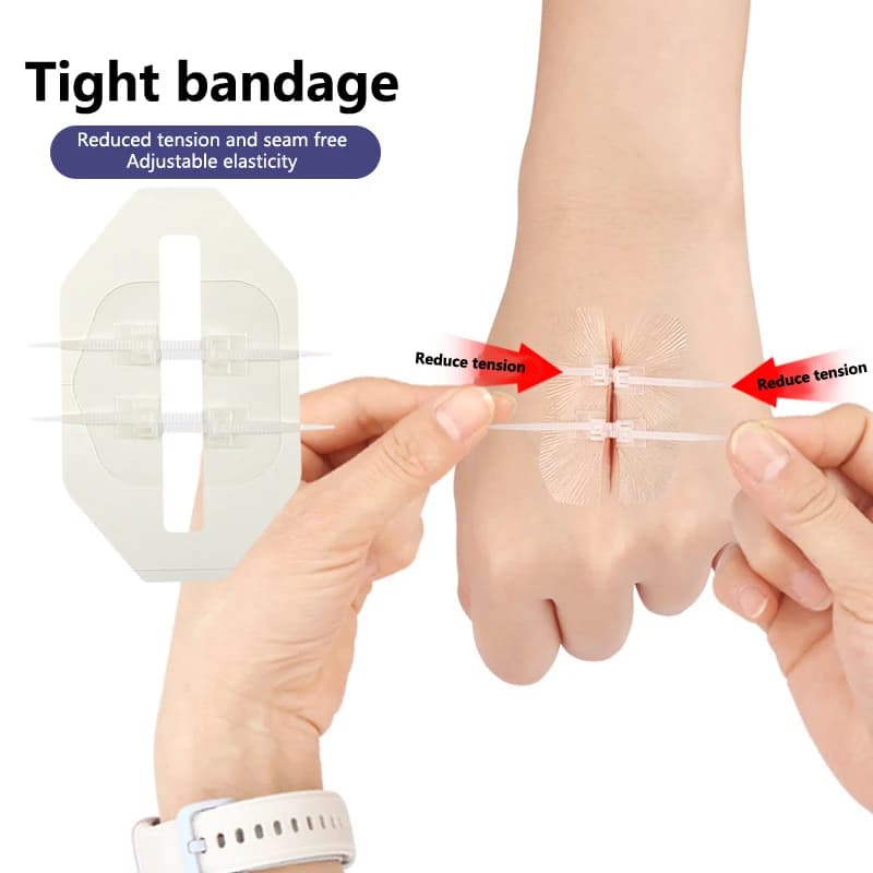 Cuciture adesive Zip Stitch per chiusura rapida di ferite, bendaggi per riparazione rapida del sangue, per pronto soccorso e sopravvivenza all'aperto
