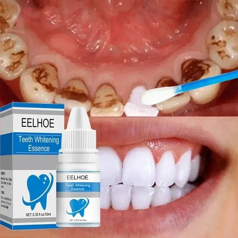 Teeth Cleaning Siero Whitening Efficace Remove Plate Siero Yellow teeth Serum for removing tooth stains Dentifricio for fresh breath