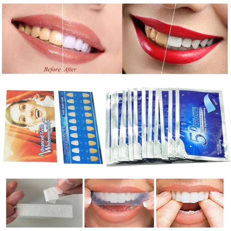 7/84 Paia Strisce Sbiancanti per Denti 5D Gel Kit Dentale Igiene Orale Strisce per Denti Finti Faccette Dentali Gel Sbiancante per Dentisti