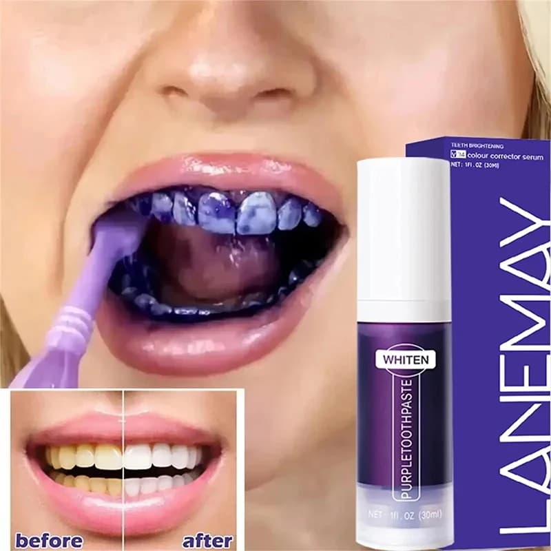 5D purple whitening toothpaste for removing plaque and stains, oral hygiene, dental whitening, fresh breath, beauty and health