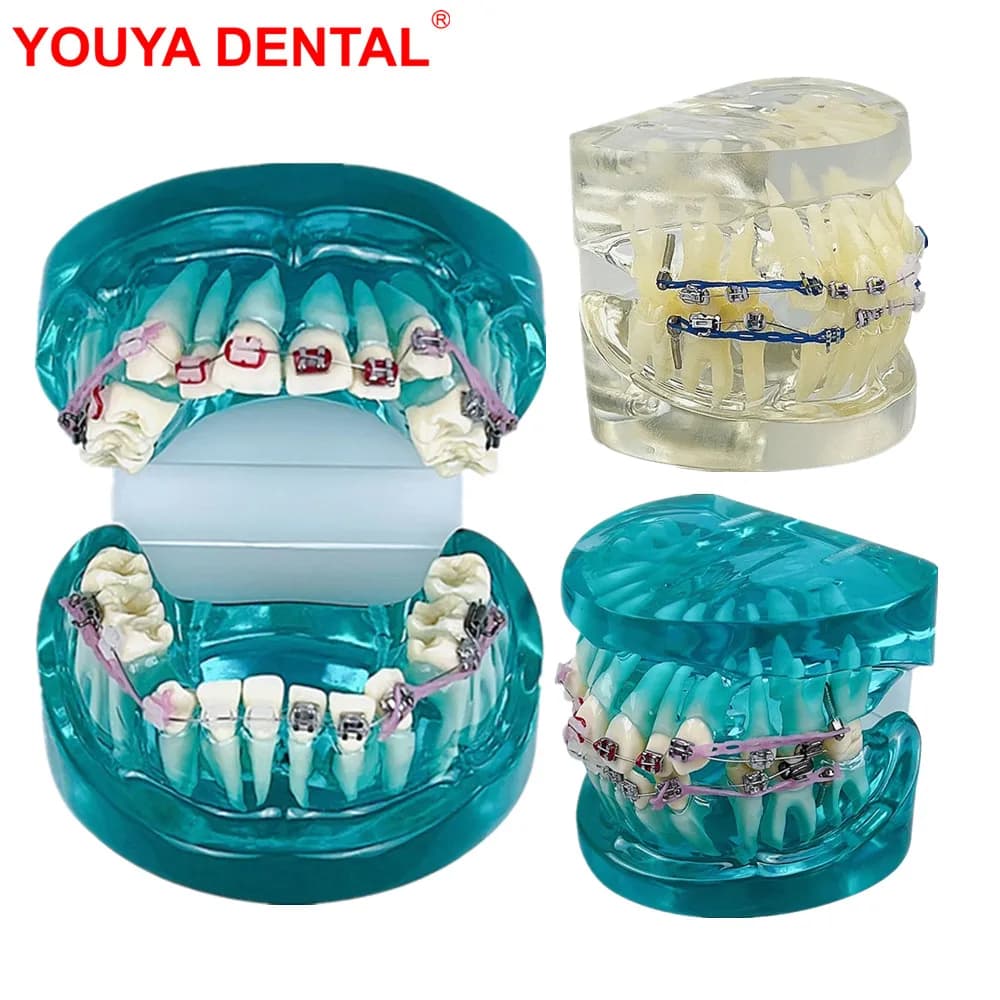 New Dental Orthodontic Treatment Model Standard Teaching Model Dental Teeth Model With Bracket Half Metal Half Ceramic 2 Colors