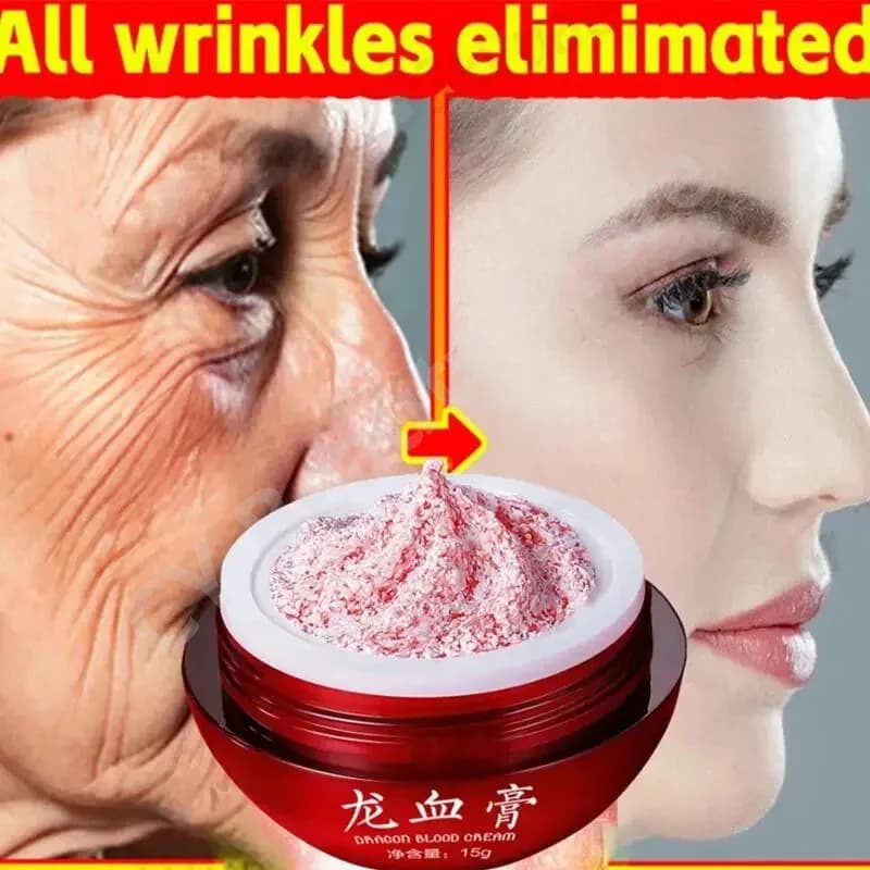 Crema al sangue di drago Rimozione delle rughe Siero viso Ringiovanimento Ascensore Rassodante Anti-età Sbiancamento Pori invisibili Bellezza Cura della pelle