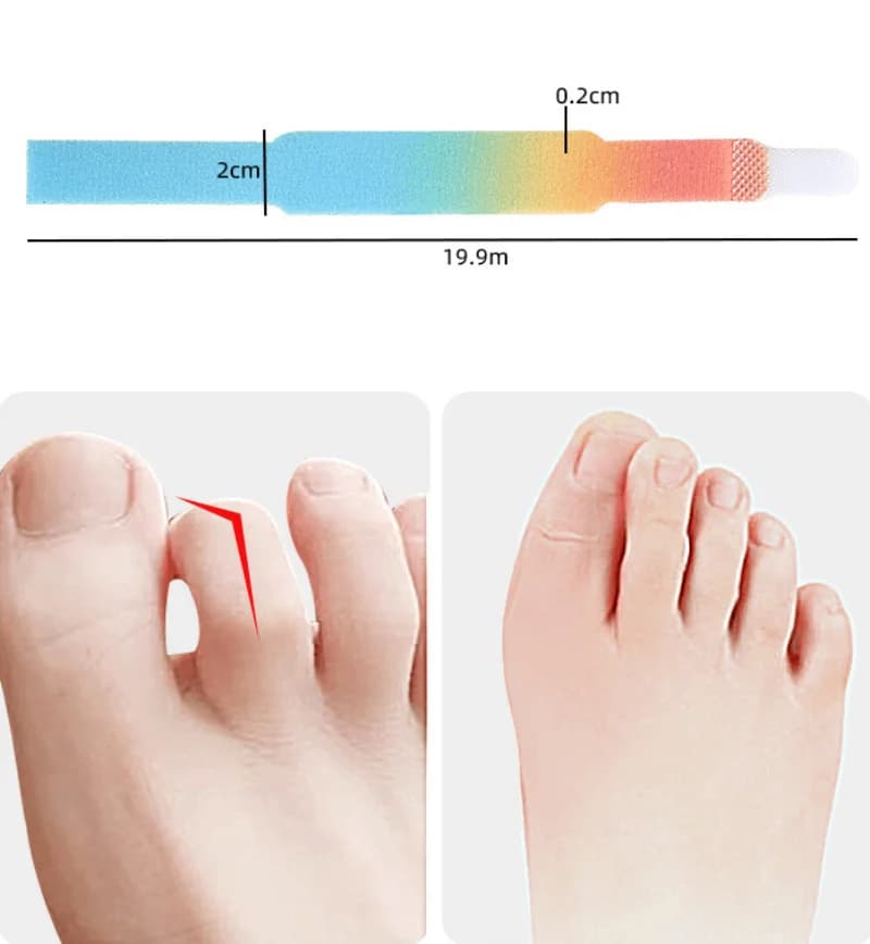 1/2 pezzi dita raddrizzatore martello punta nastro alluce valgo correttore fasciatura separatore della punta stecca avvolge forniture per la cura del piede