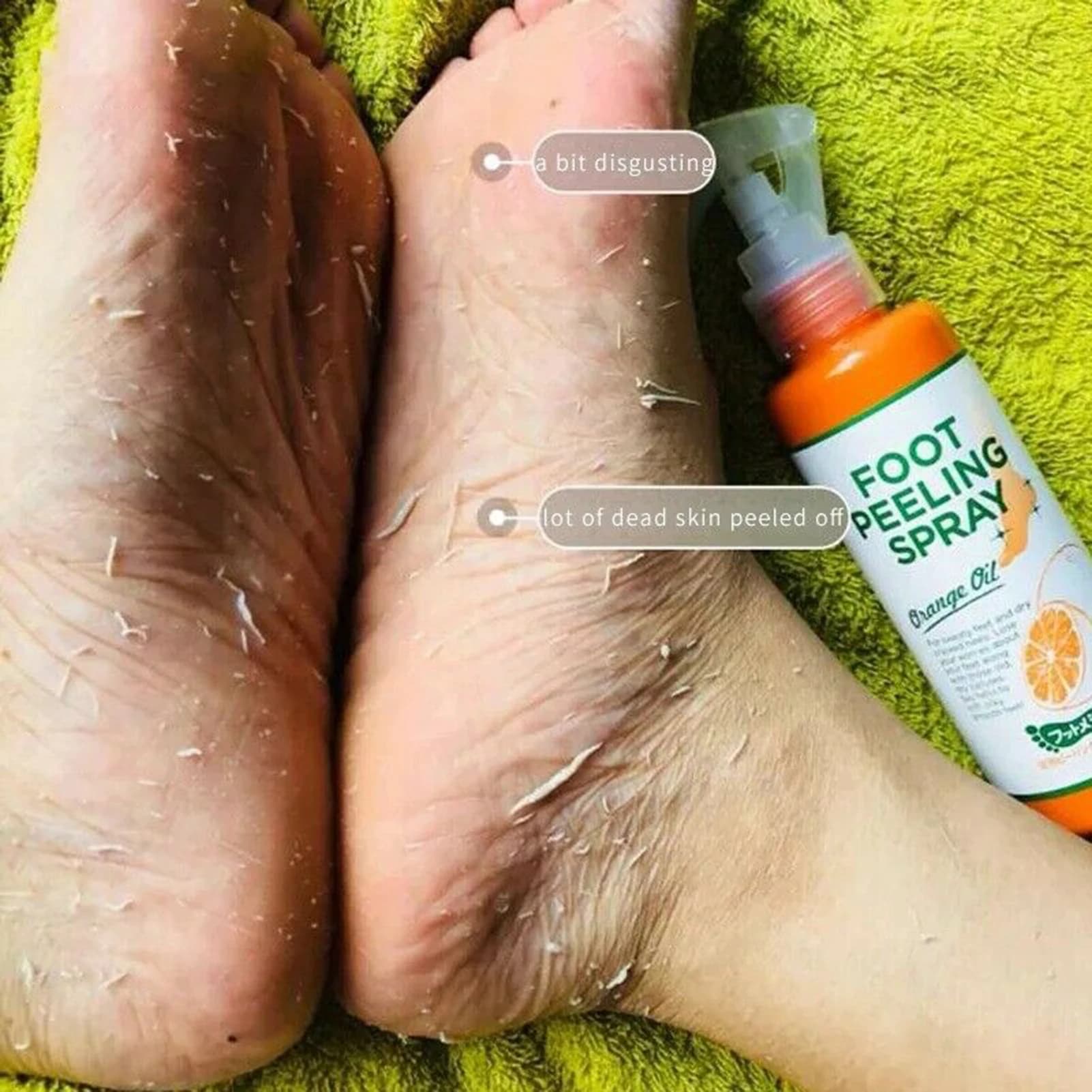 110ML foot Peeling spray improves rough skin available throughout the body