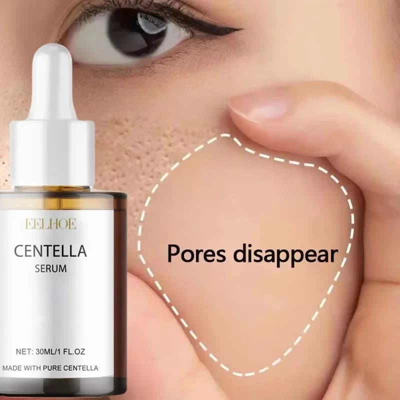 Siero Viso alla Centella Asiatica per Ridurre i Pori, Crema per Soffocare Rossori e Vene Visibili, Idratante e Illuminante, Prodotto Coreano per la Cura della Pelle