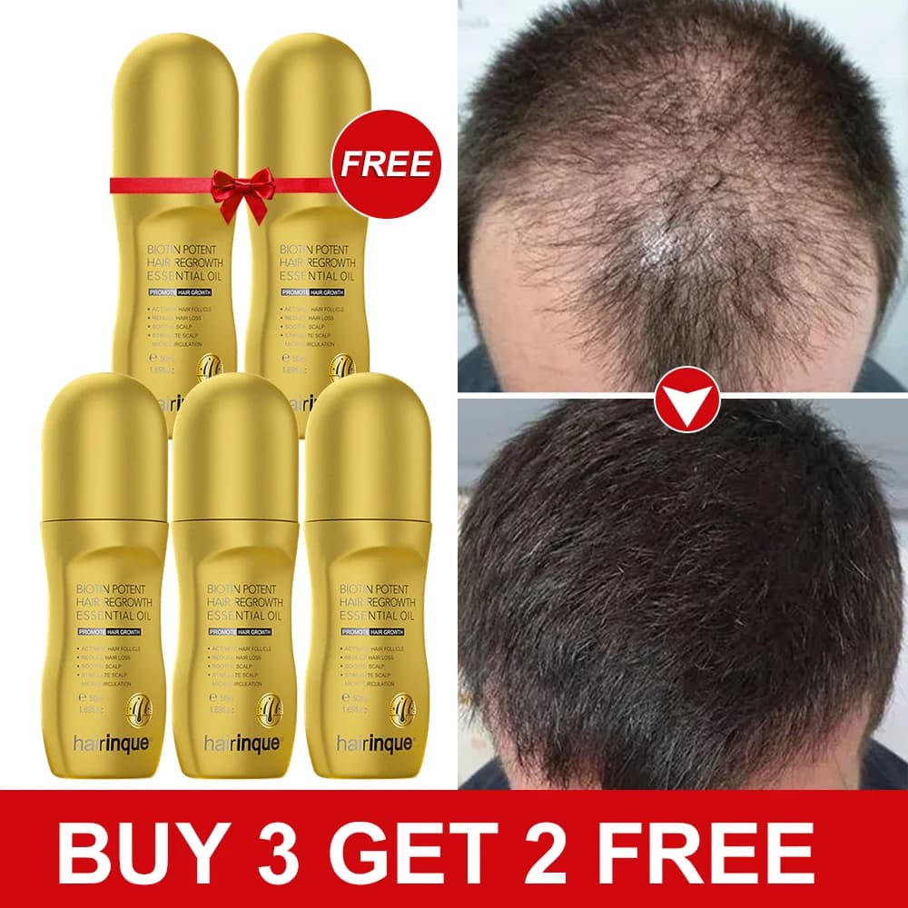 Hairinque biotina crescita dei capelli per uomo donna Set vitamina ricrescita dei capelli addensare calvizie prevenzione cura dei capelli olio bellezza salute