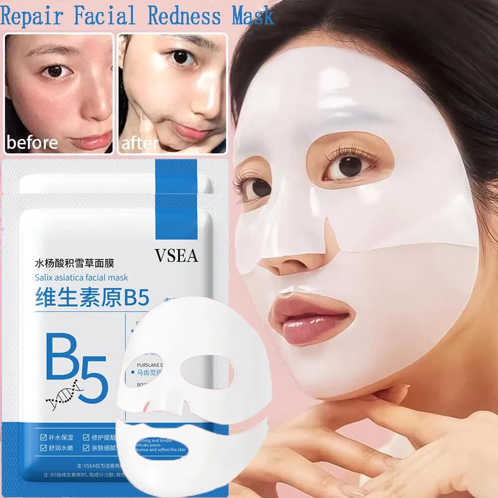 Reparative mask for face redness Quickly improves dryness of sensitive skin Hydrating serum Removal of soothing Red Blood Rose Care Beauty