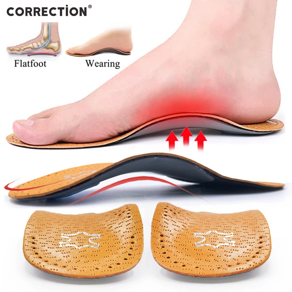 Soletta ortopedica in pelle di correzione per piedi piatti supporto arco O/X gamba scarpe ortesi solette suola per piedi uomo donna bambini