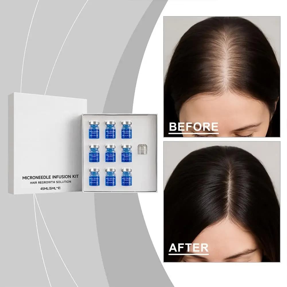 Set di Micro-Aghi con Siero Essenziale per Capelli da 0,25mm, Nutrimento per Follicoli, Cura del Cuoio Capelluto, Essenza Condizionante per Ispessimento dei Capelli
