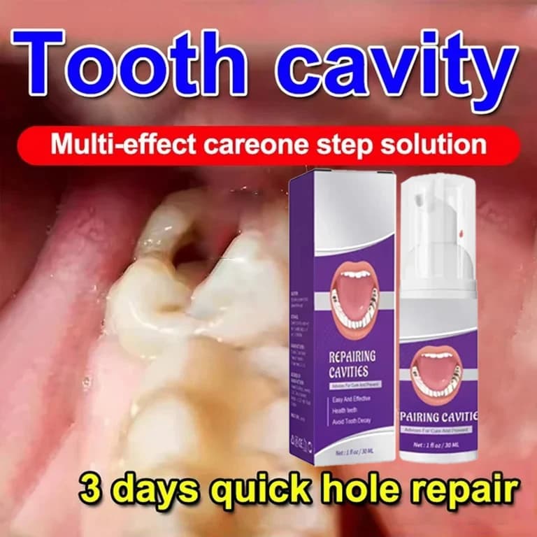 Dentifricio per la pulizia dei denti Rimuove le macchie dei denti Sbiancamento dei denti Riparazione della carie dei denti Calcolo Placca Periodontite Rimuovi le cavità