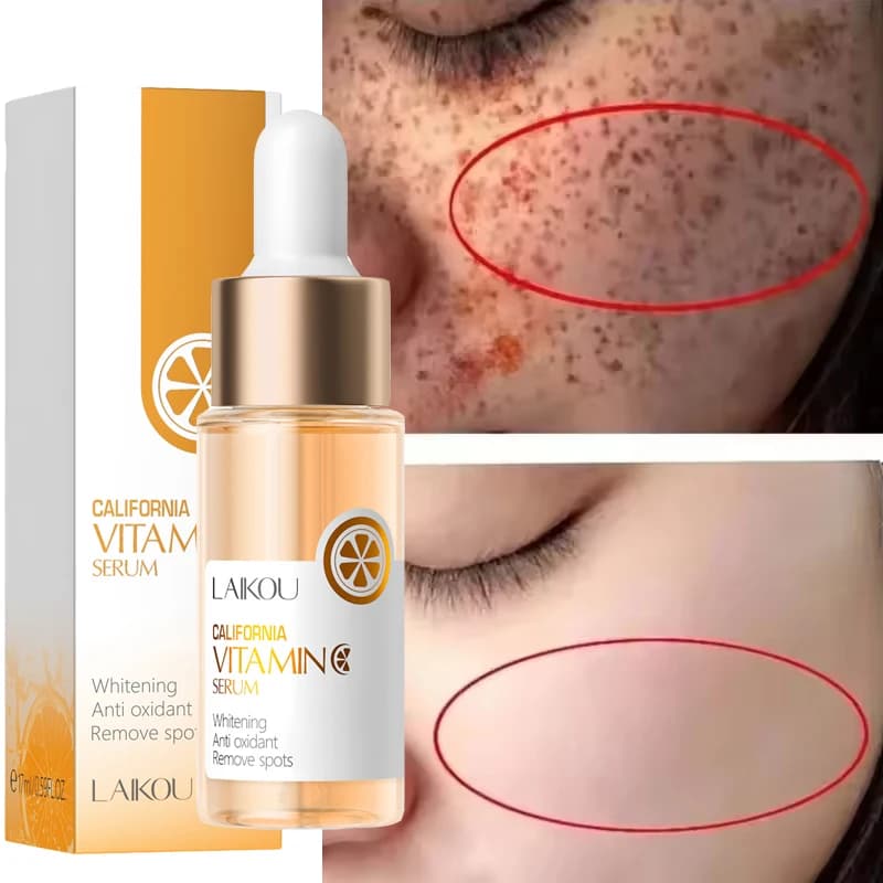 Vitamin C Whitening Serum Lentiggine Remove The Essence Dissolvency Pigmentation Melasma Macchie Dark Corrector Serum Reparator Korean Skin Care