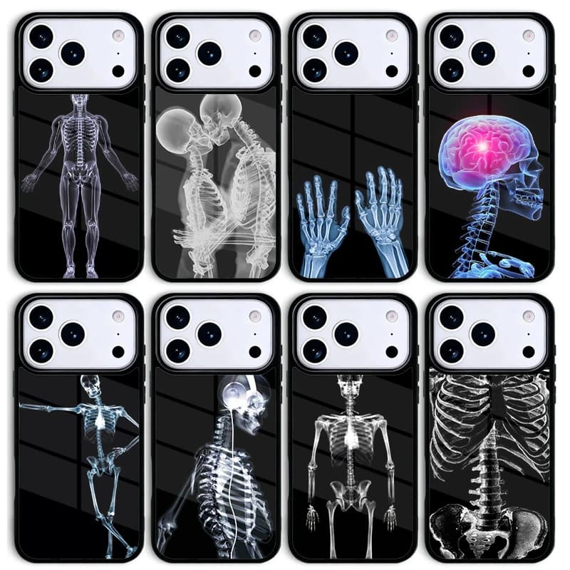 Cover per iPhone con Stampa Anatomia Umana a Raggi X per Apple iPhone 17 Air 16 Pro Max 15 Pro Max 14 13 12 11 Mini