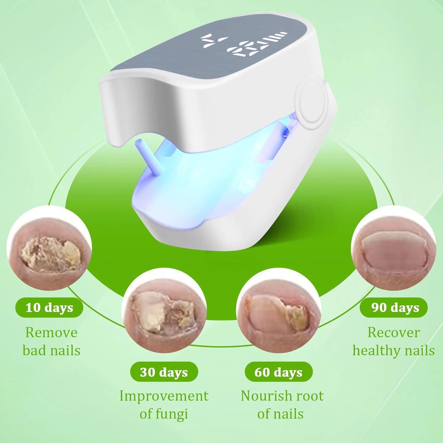 Portable Laser Device for Nail Mushroom Treatment Foot Nail Repair Anti-fungal Tools USB Charge