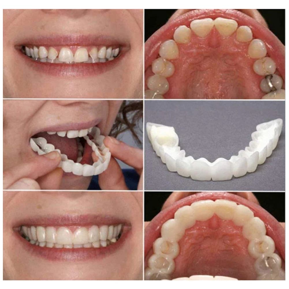 Set di Dentiere Temporanee Ortodontiche Più Venduto, Denti Finti per Igiene Orale e Sbiancamento, Simulazione CK848-fro
