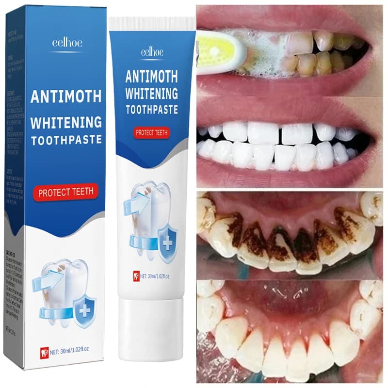Quick removal of smoke stains Dentifricio Remove plaque stains Oral hygiene Cleansing Fresh breath Teeth whitening Tools Oral health care