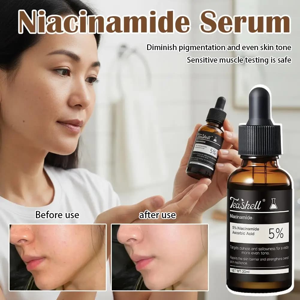 Siero viso al 5% di niacinamide 30ml, essenza sbiancante alla vitamina C per la rimozione delle macchie scure, illuminante per la pelle opaca, riparatore per il viso, cura della pelle