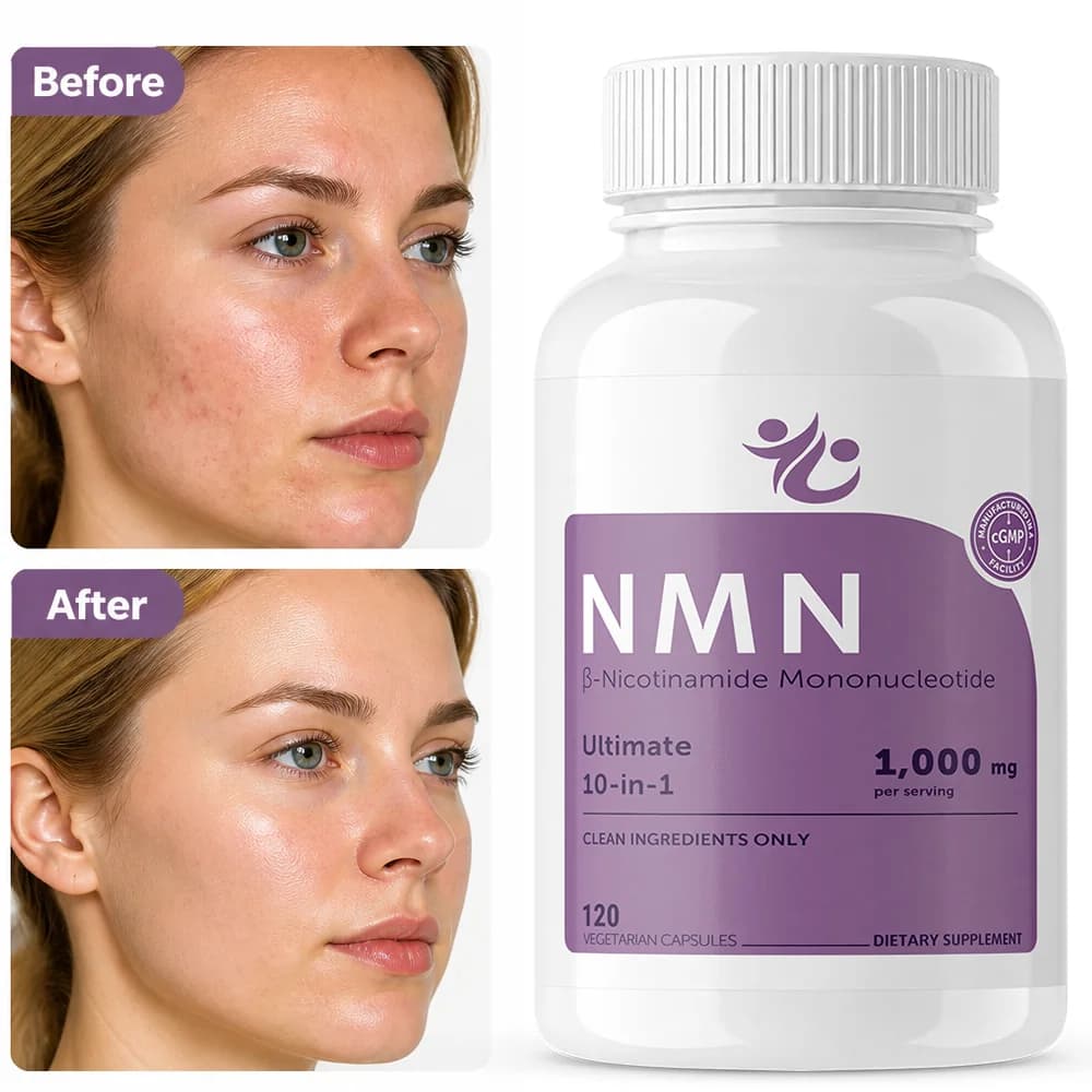 NMN Complex 1,000mg, 10-in-1 with Nicotinamide Mononucleotide, Vitamin C, Resveratrol, CoQ10, NAD+ Supplement Precursor