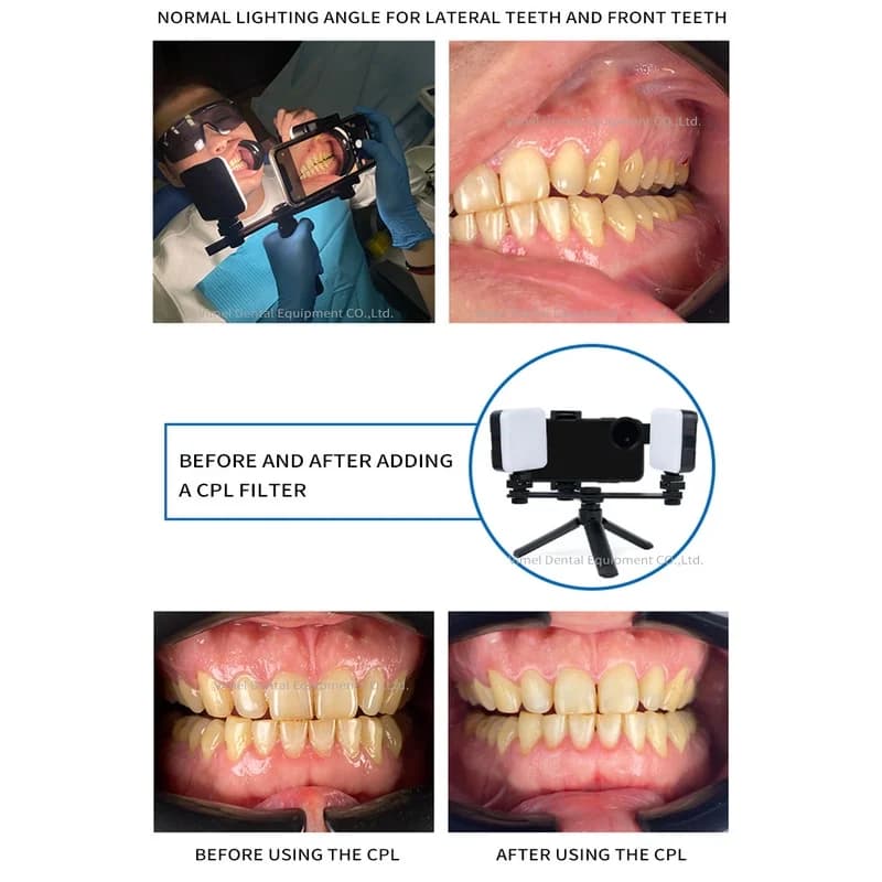 Attrezzatura dentale bocca tiro luce di riempimento del telefono cellulare treppiede portatile piccola lampada colorimetrica intelligente LED fotografia orale