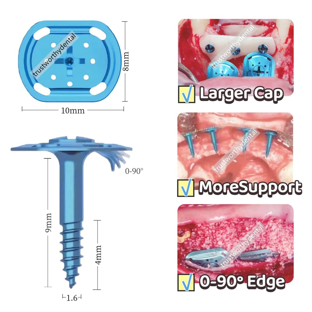 Dental GBR Bone Tent Screw Wide Head Support Space Half Thread Big Tenting Screw Guide Bone Regeneration Membrane Shield 10mm