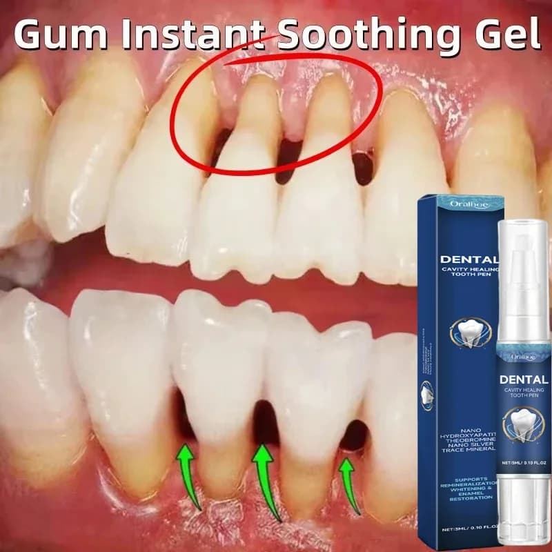 Quick Repair Damaged Gyms Serum Gel Relieve Tooth Allergy Dental Caries Tooth Cleaning Dentifricio Deep Cleaning Teeth Macchia